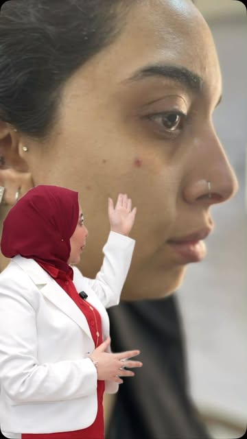 Dr. Heba reel