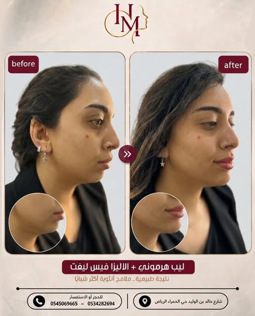 Dr. Heba post