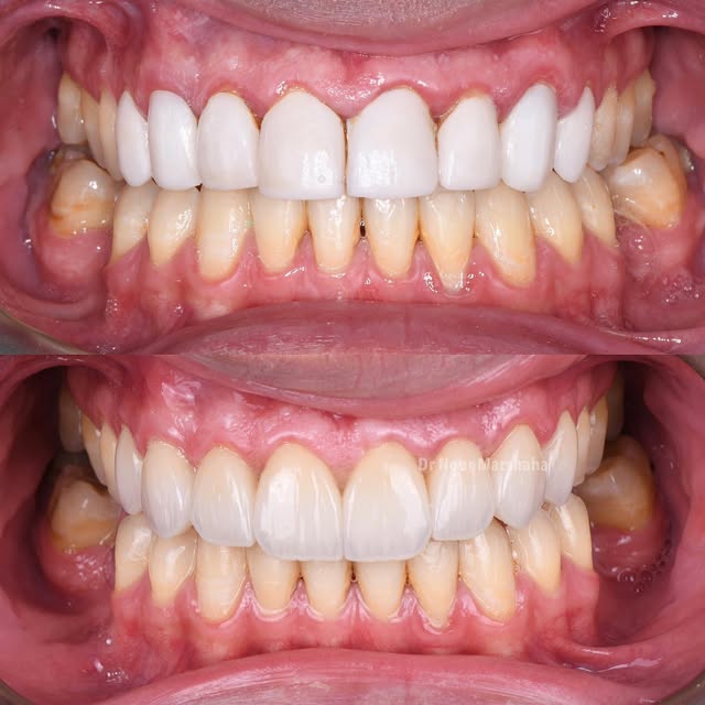 Dr. Nour reel